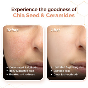 Chia seed ceramides before after skin results