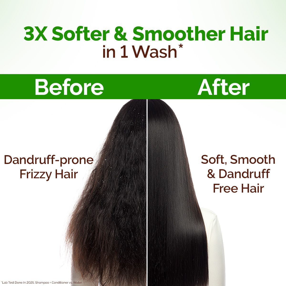 Lemon Anti-Dandruff Conditioner with Lemon & Aloe Vera for Itchy & Flaky Scalp - 250 ml