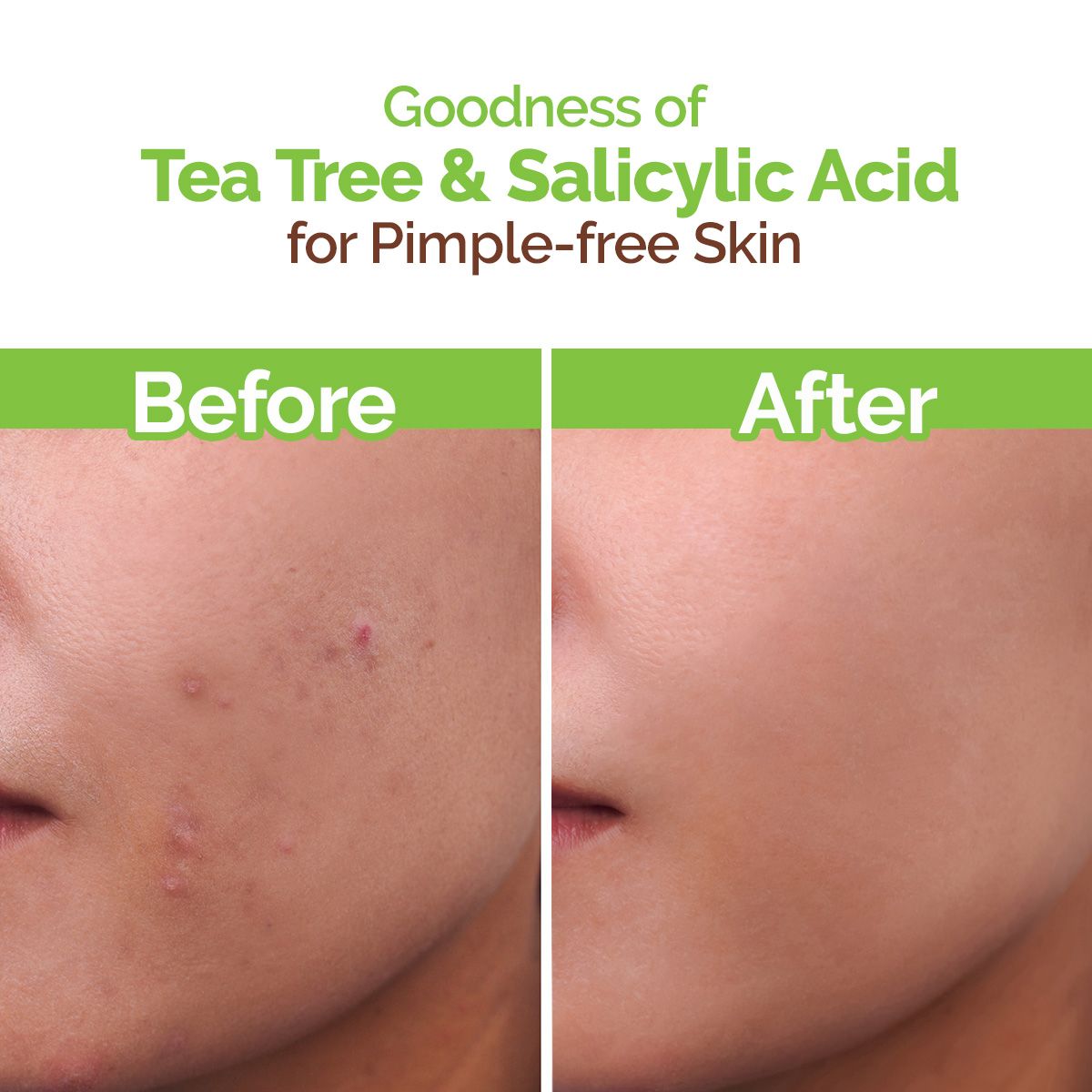 Tea Tree Pimple Control Face Wash with Tea Tree & Salicylic for Oily & Acne-Prone Skin - 100ml