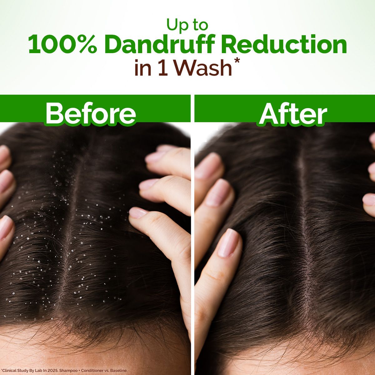 Lemon Anti-Dandruff Shampoo with Lemon & Aloe Vera for Itchy & Flaky Scalp - 400ml