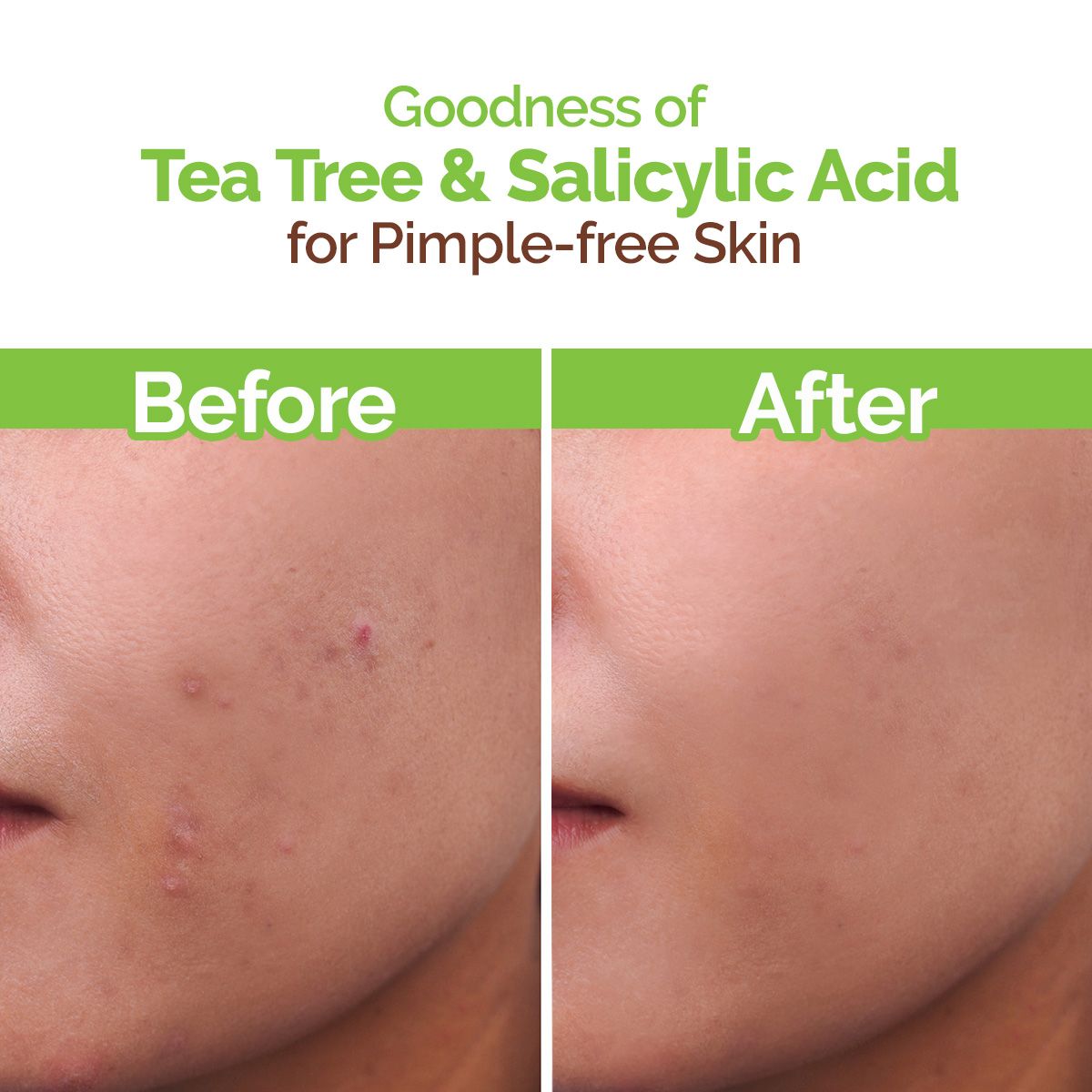 Tea Tree Pimple Control Face Wash with Tea Tree & Salicylic for Oily & Acne-Prone Skin - 150ml