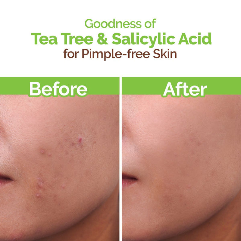 Tea Tree Pimple Control Face Wash with Tea Tree & Salicylic for Oily & Acne-Prone Skin - 150ml