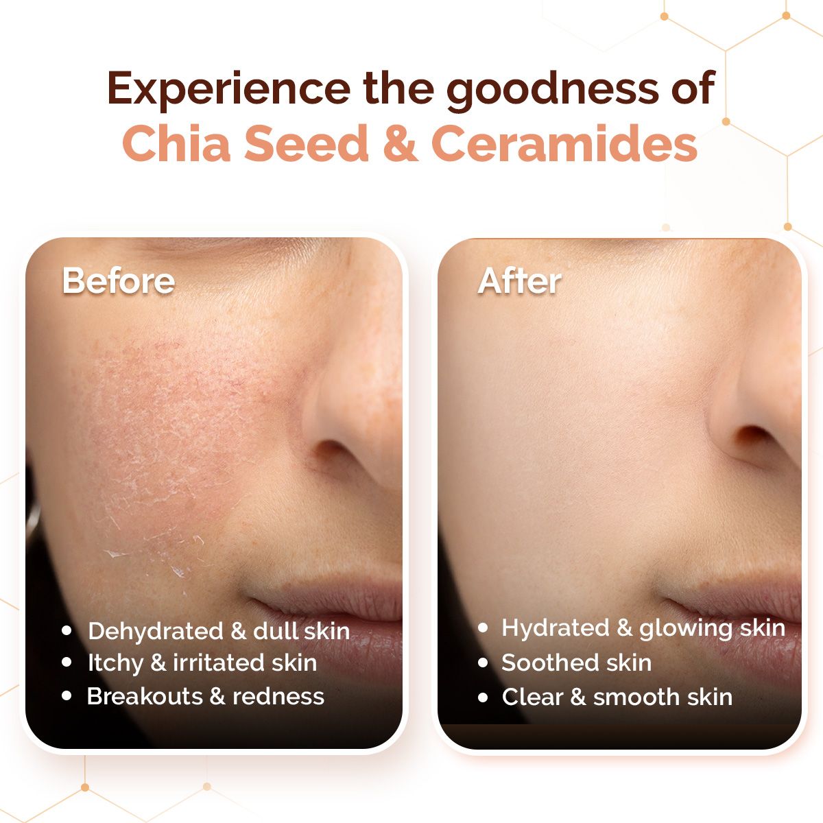 Chia Oil-Free Moisturizer with Chia Seed & Ceramides for Hydrated Glow - 80 g