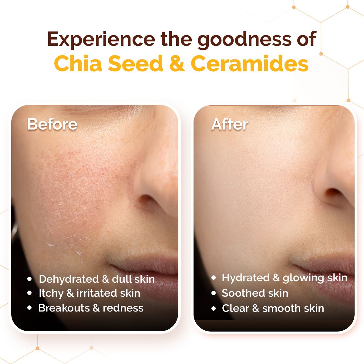 Chia Calming Sunscreen with Chia Seed & Ceramides for Hydrated Glow & Sun Protection - 50 g