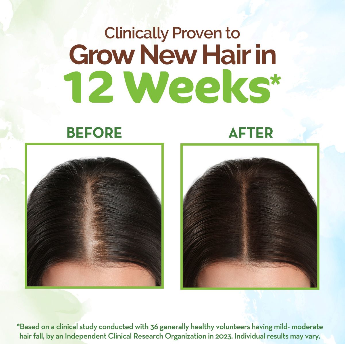 Rosemary Hair Growth Oil with Rosemary & Methi Dana for Promoting Hair Growth - 200 ml