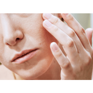 SOOTHES RASHES, ACNE PIMPLES