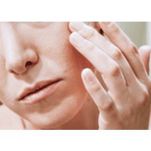 SOOTHES RASHES, ACNE PIMPLES