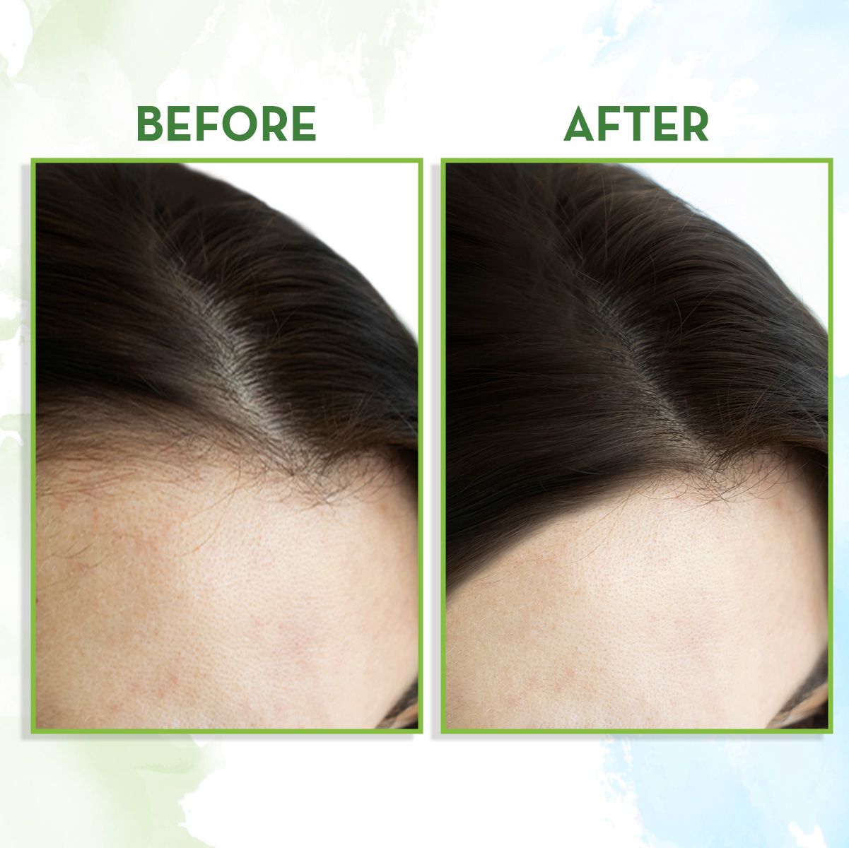Rosemary Essential Oil for Hair Growth - 15 ml