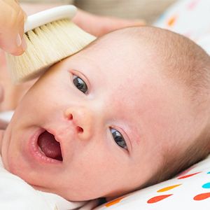 Soothes Cradle Cap