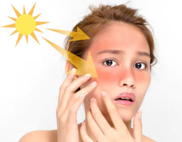 Sun Damage Repair